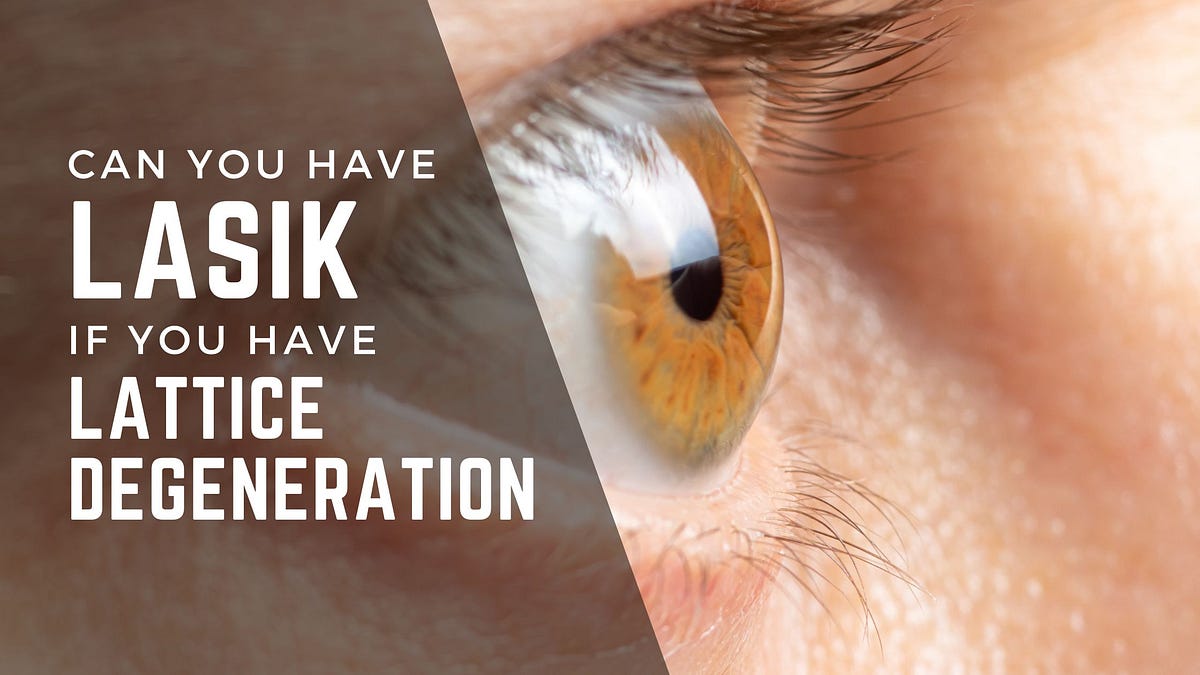Can You Get LASIK If You Have Lattice Degeneration by Eye Hospital