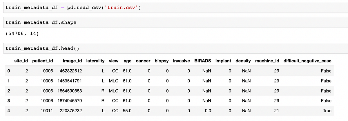 Augment Breast Cancer Diagnosis with Image Classification and LLMs | by ...