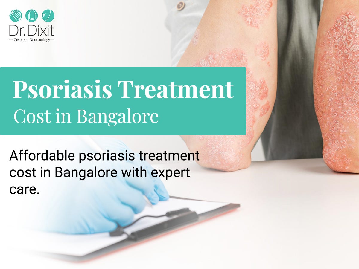 Psoriasis- Frequently Asked Questions on Psoriasis and Its Treatment Answered by a Dermatologist