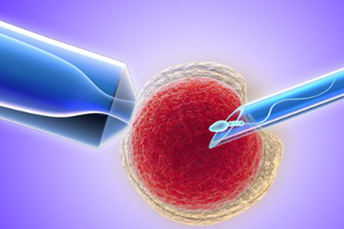 ICSI: Your Step-By-Step Overview. Fertility treatments ...