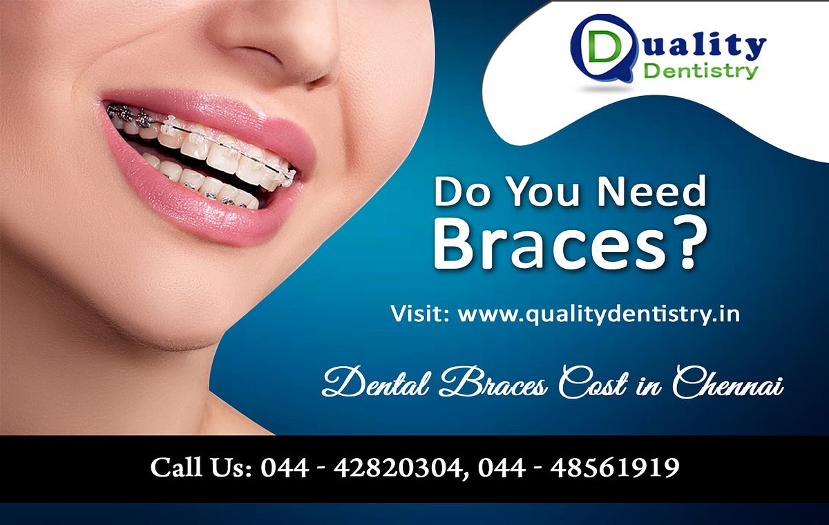 DESCRIPTION ABOUT BRACES AND ITS TYPES by vangarsmith Medium