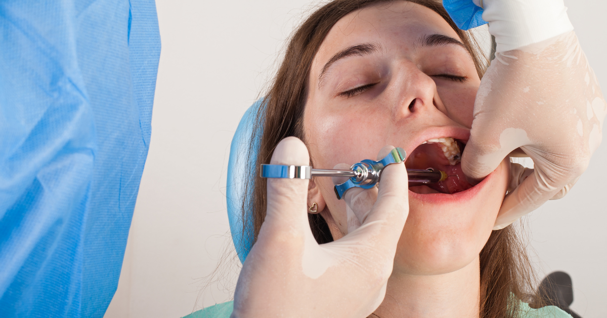 The Different Types of Dental Anesthesia What You Need to Know by
