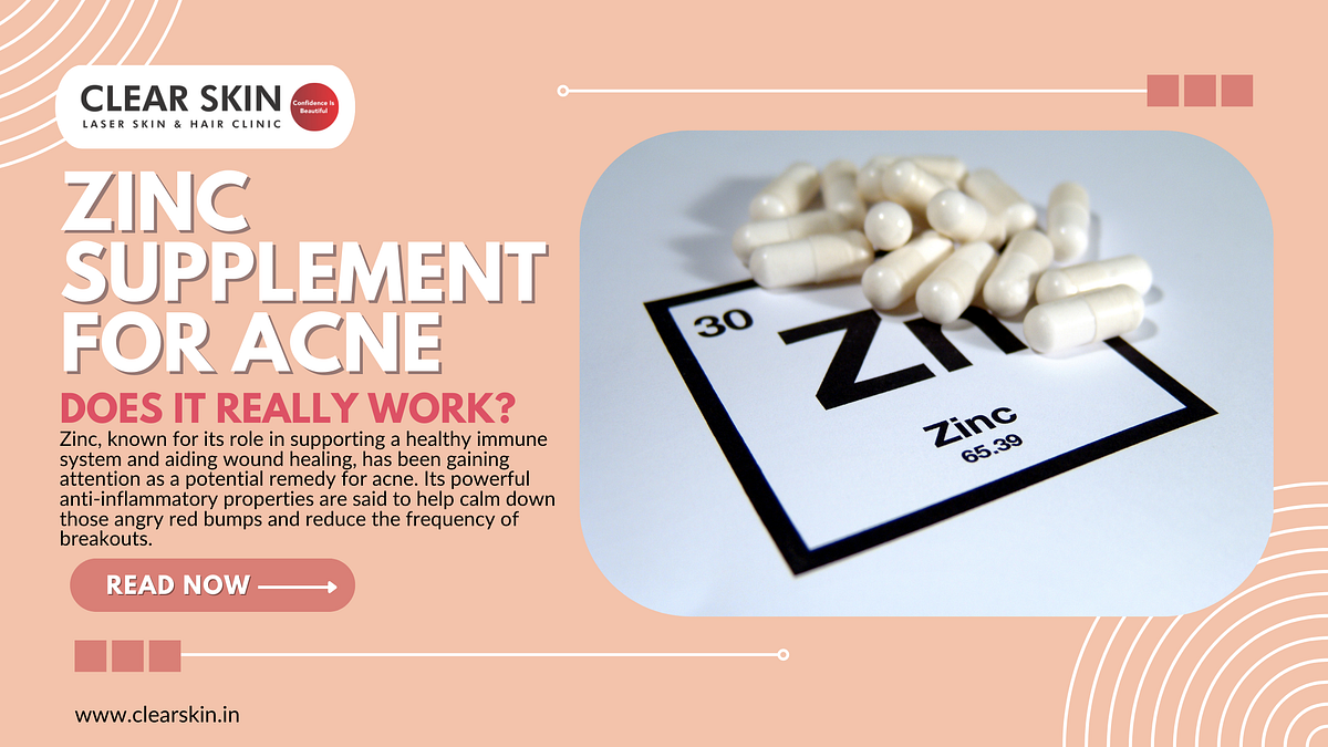 Zinc Supplement for Acne Does it Really Work? by ClearSkin Laser