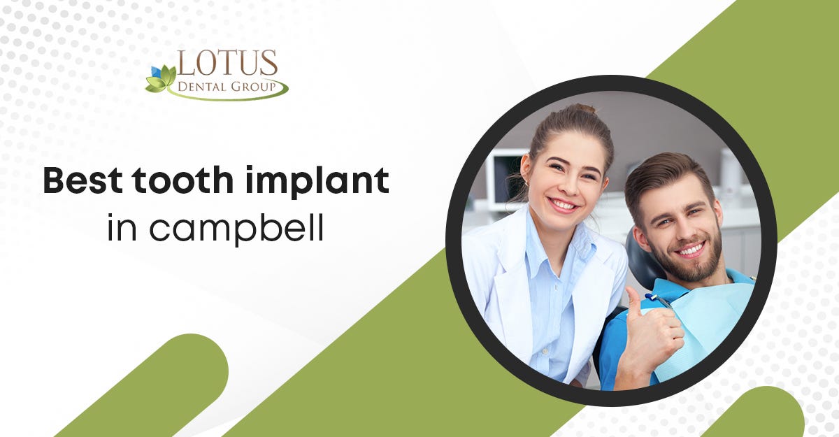 Best Tooth Implant in Campbell A Guide to Lotus Dental Group by