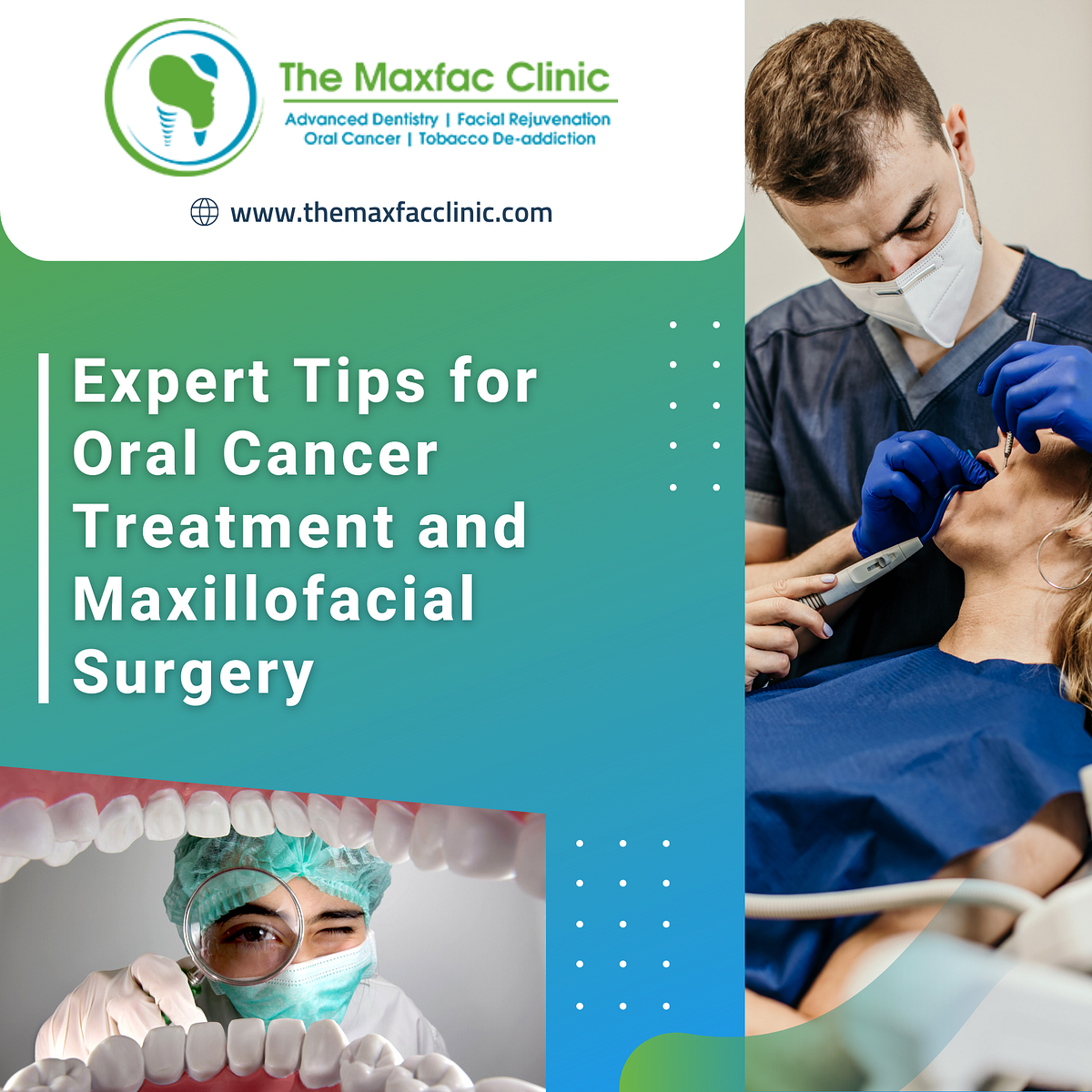 Expert Tips for Oral Cancer Treatment and Maxillofacial Surgery by