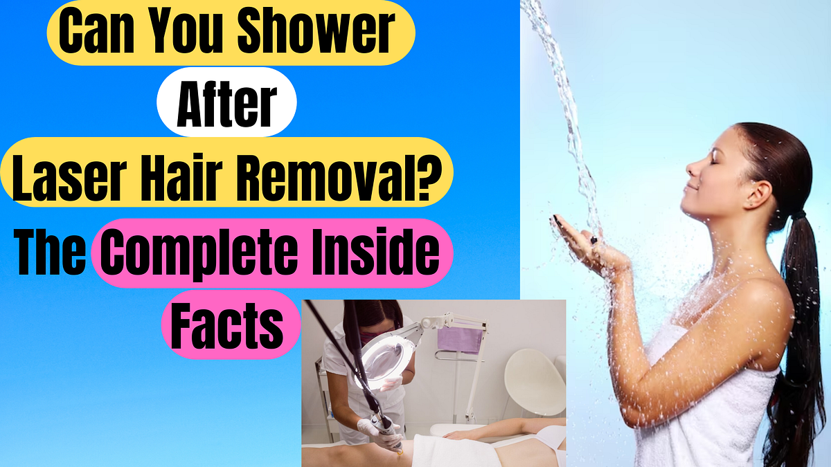 Can You Shower After Laser Hair Removal? The Complete Inside Facts by
