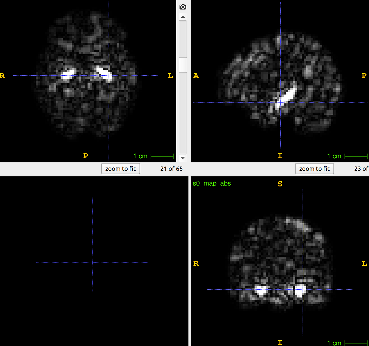 A good Python plotting tool for nii image: Nilearn | by Di Wang | Medium