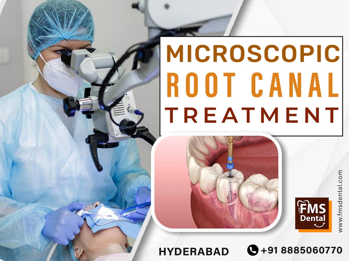 Microscopic Root Canal Treatment at FMS Dental Hospital in Hyderabad
