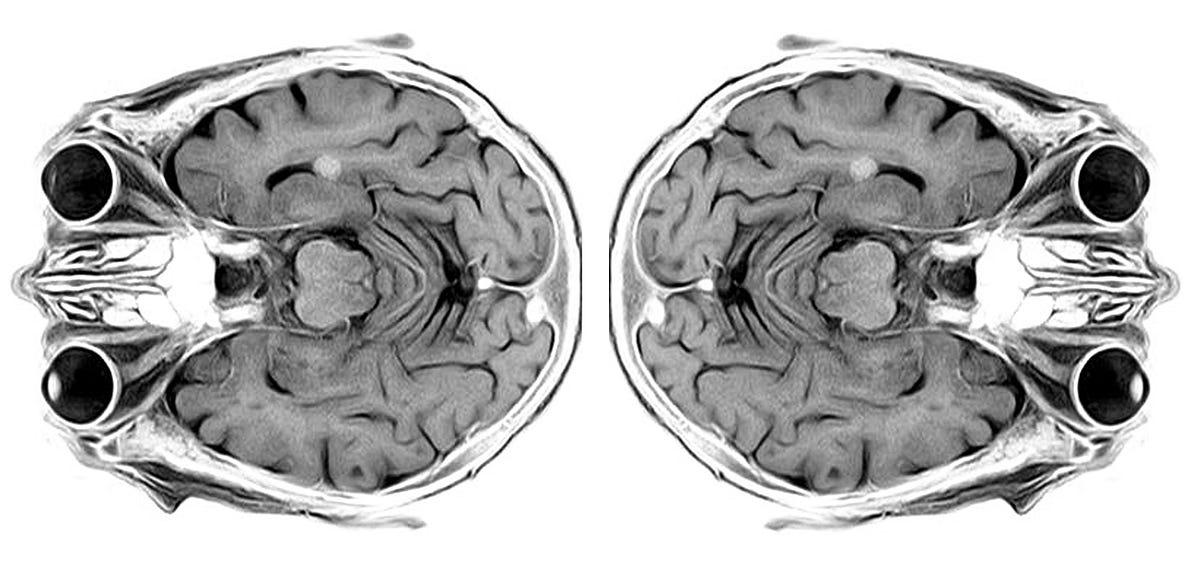 Intro to Analyzing Brain Imaging Data— Part I: fMRI Data Structure | by ...
