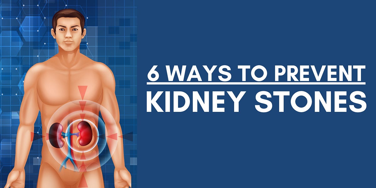 6 Ways to Prevent Kidney Stones. Kidney Stone Prevention by Dr
