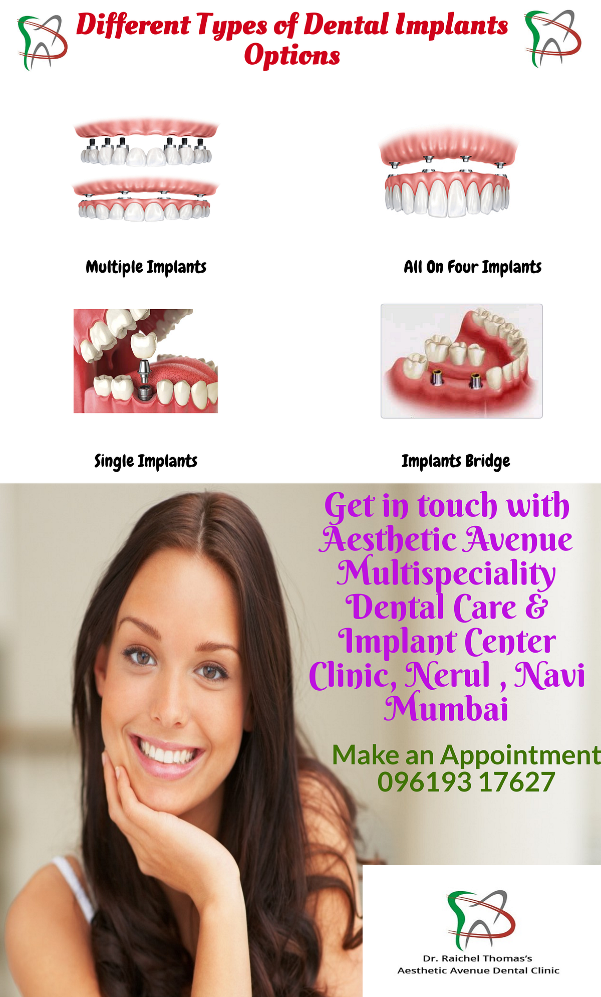 Dental Implantation at Aesthetic Avenue Dental Clinic, Nerul, Mumbai