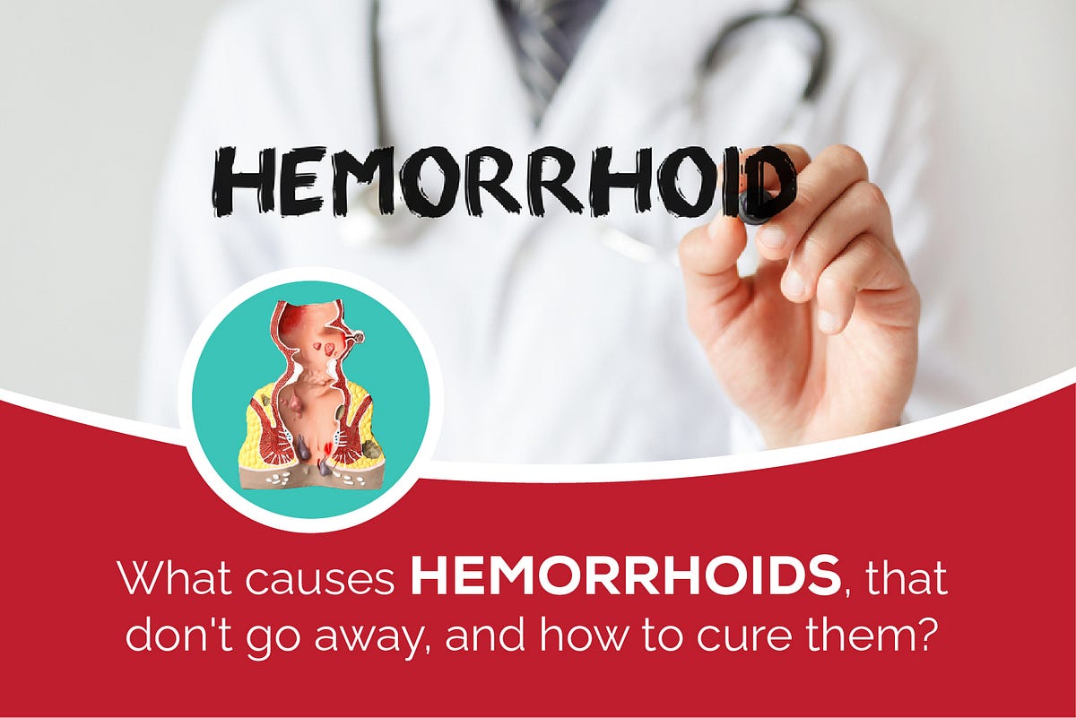 What causes hemorrhoids that don’t go away, and how to cure them? by