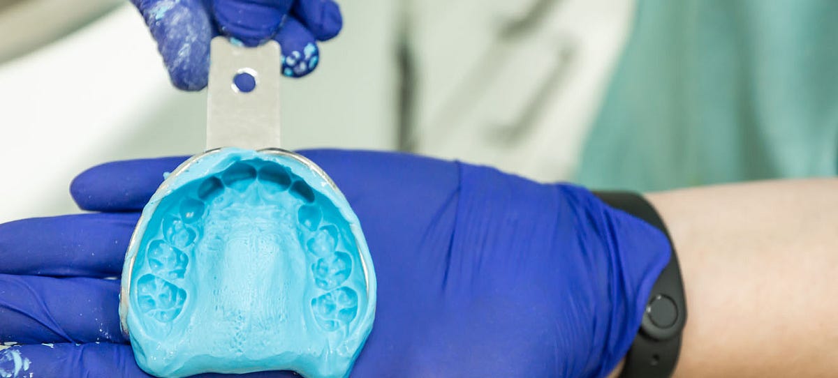 The Art and Science of Dental Impressions A Closer Look by The Curve Dental Clinic Dubai
