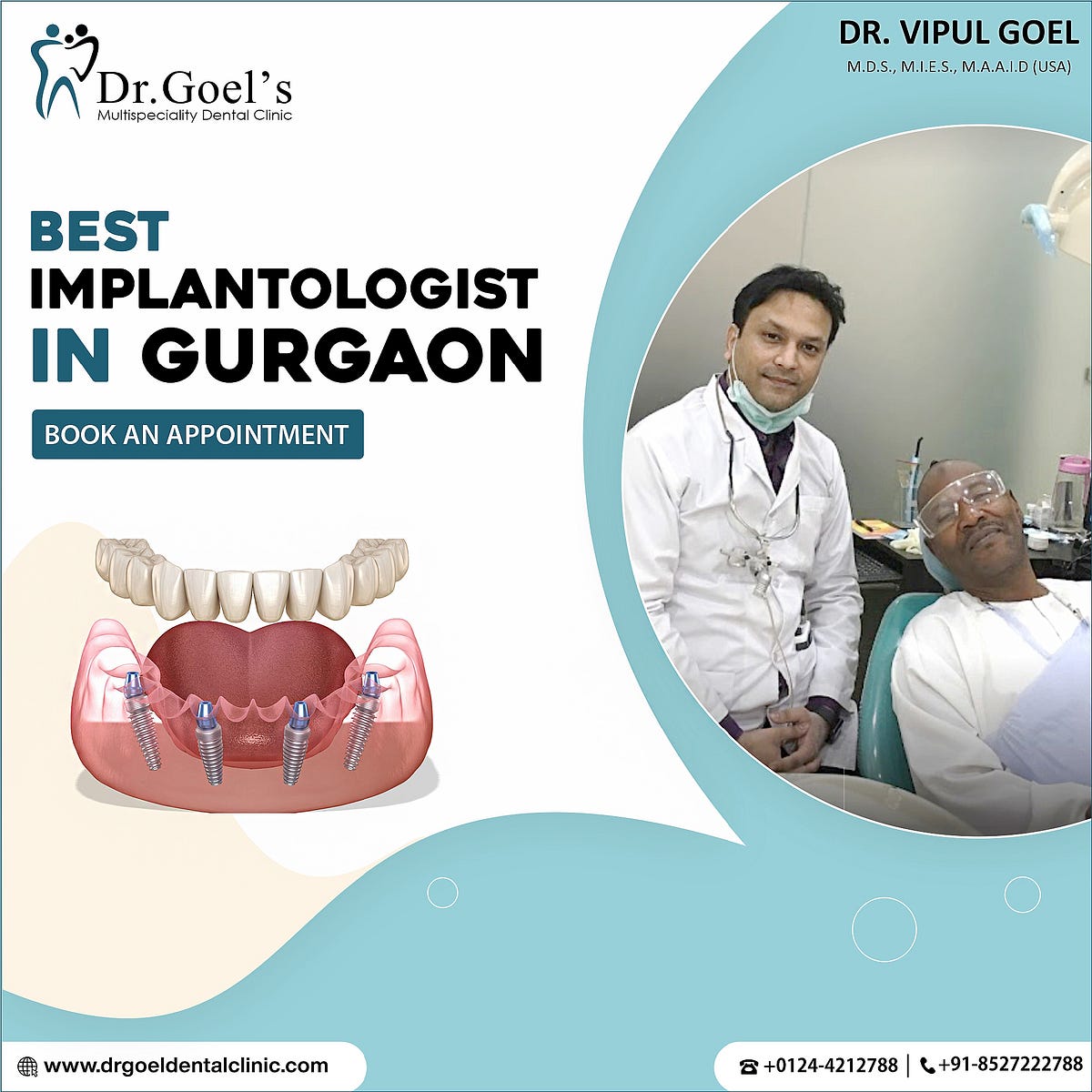 Dentists In Gurgaon. One of Gurgaon’s most renowned… by DrGoels