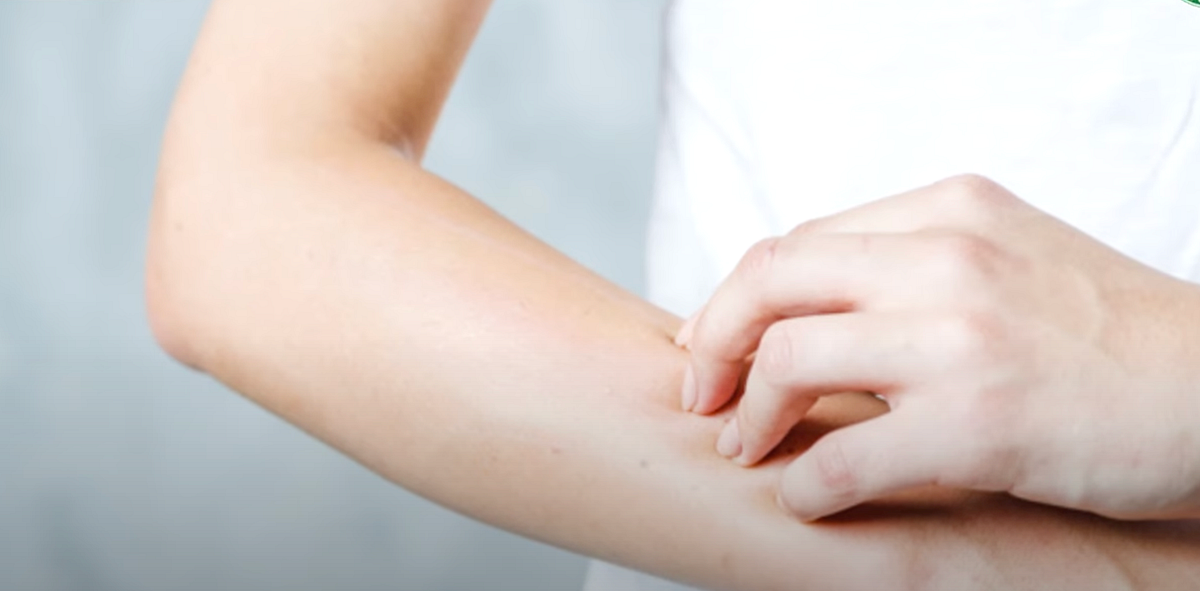 Moisture Matters Treating and Preventing Dry Skin After Showers by