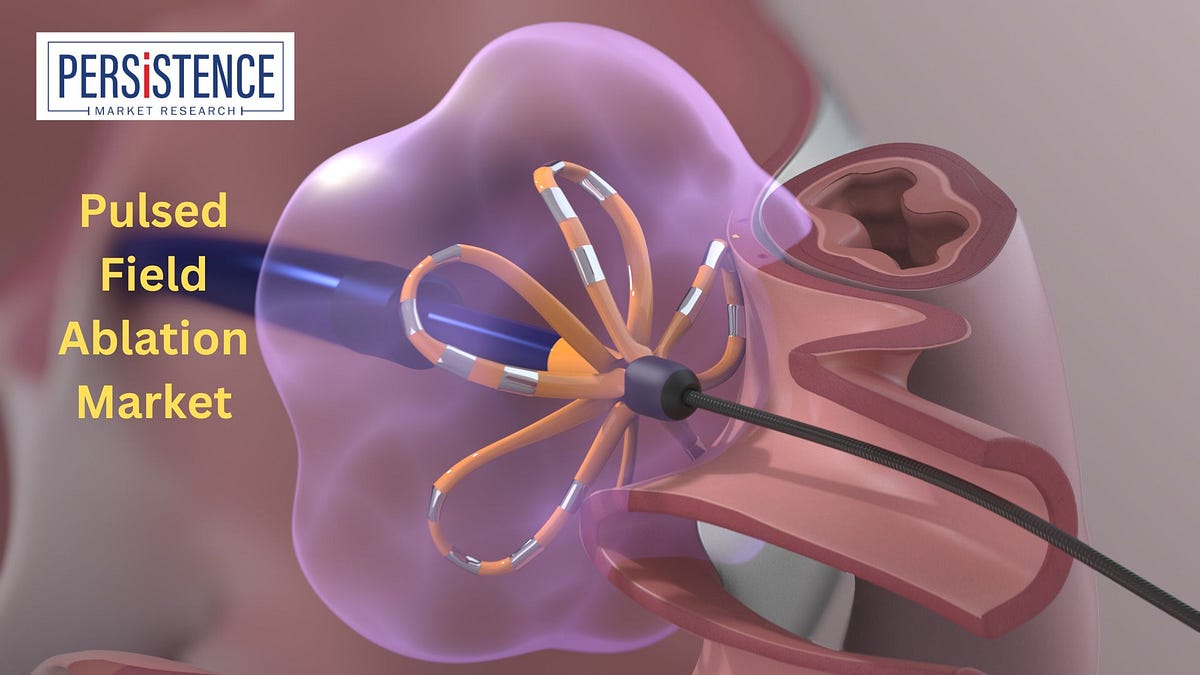 Pulsed Field Ablation Market Top 10 Technology Trends to Watch in 2024 ...