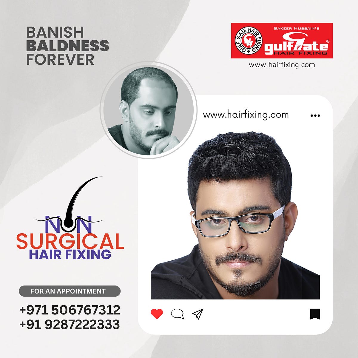 Gulf Gate Hair Fixing Rates In Dubai The Ultimate Guide to Hair Fixing by GULF GATE: Solutions for a Perfect
