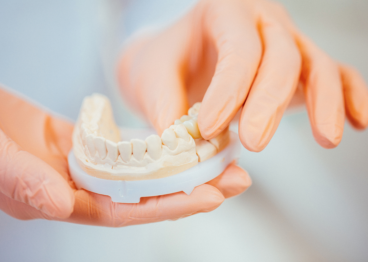 How much money does dentures cost? by Dental care Medium
