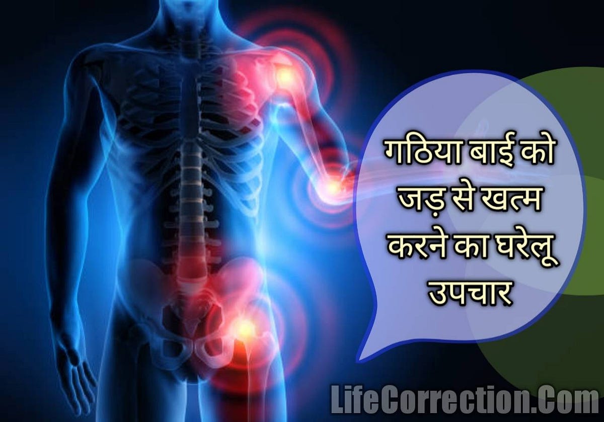 Gathiya bai ka gharelu upchar. गठिया क्या है? (Gathiya kya hai full