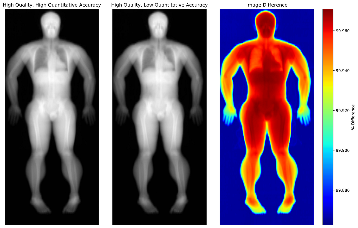 AI Predicts Your Insides From Your Outsides With Pseudo-DXA | by Lambert T Leong, PhD | Feb, 2024