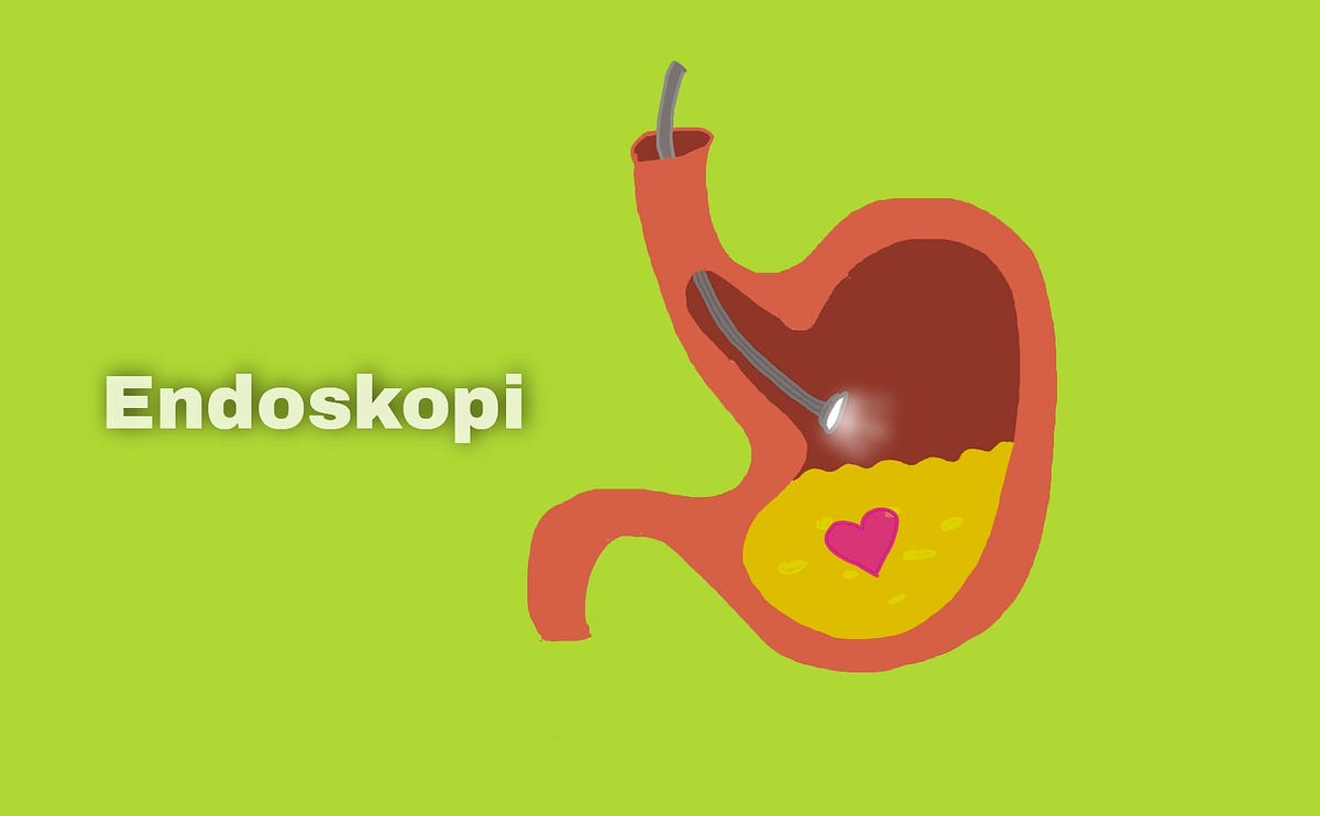 Romansa Endoskopi. Ahoy! by emey.txt Medium