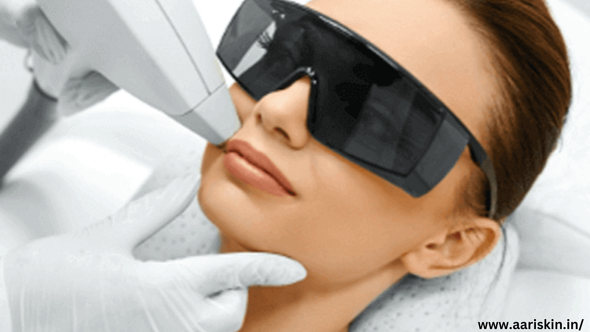 Cost Of Permanent Laser Hair Removal Treatment In Jaipur — Aari Skin