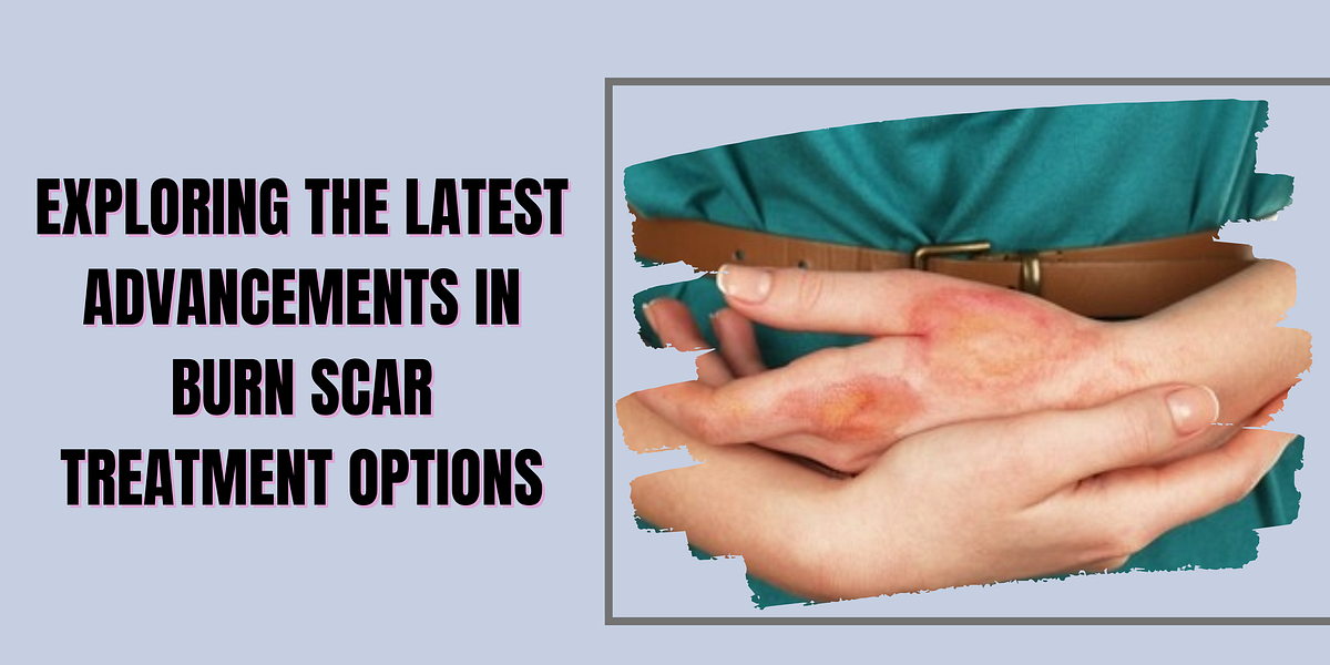 Exploring the Latest Advancements in Burn Scar Treatment Options by Shamna Sherin Aug, 2023