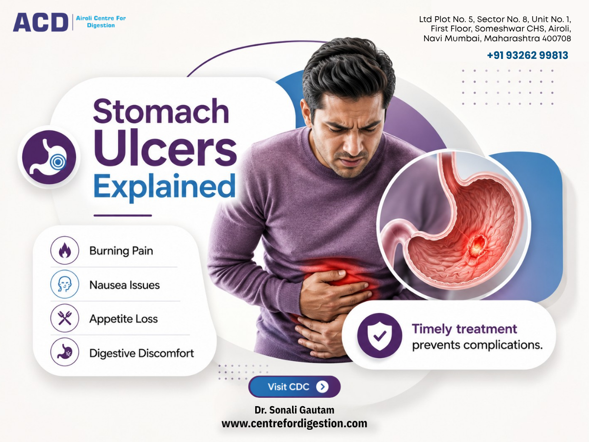 Stomach Ulcers: Know the Warning Signs Before They Become Serious