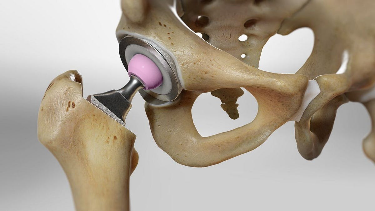 8 Benefits of Advanced Hip Replacement Treatment in Lincolnshire You ...