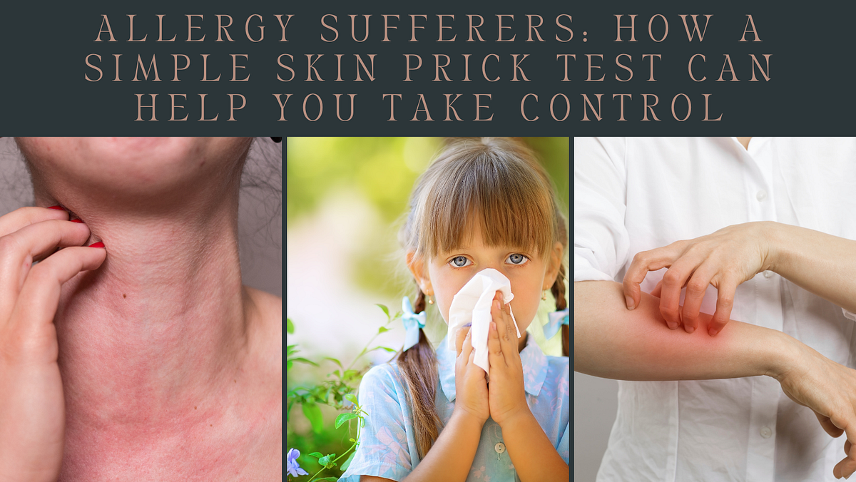 Allergy Sufferers How a Simple Skin Prick Test Can Help You Take Control by Olivia Medium