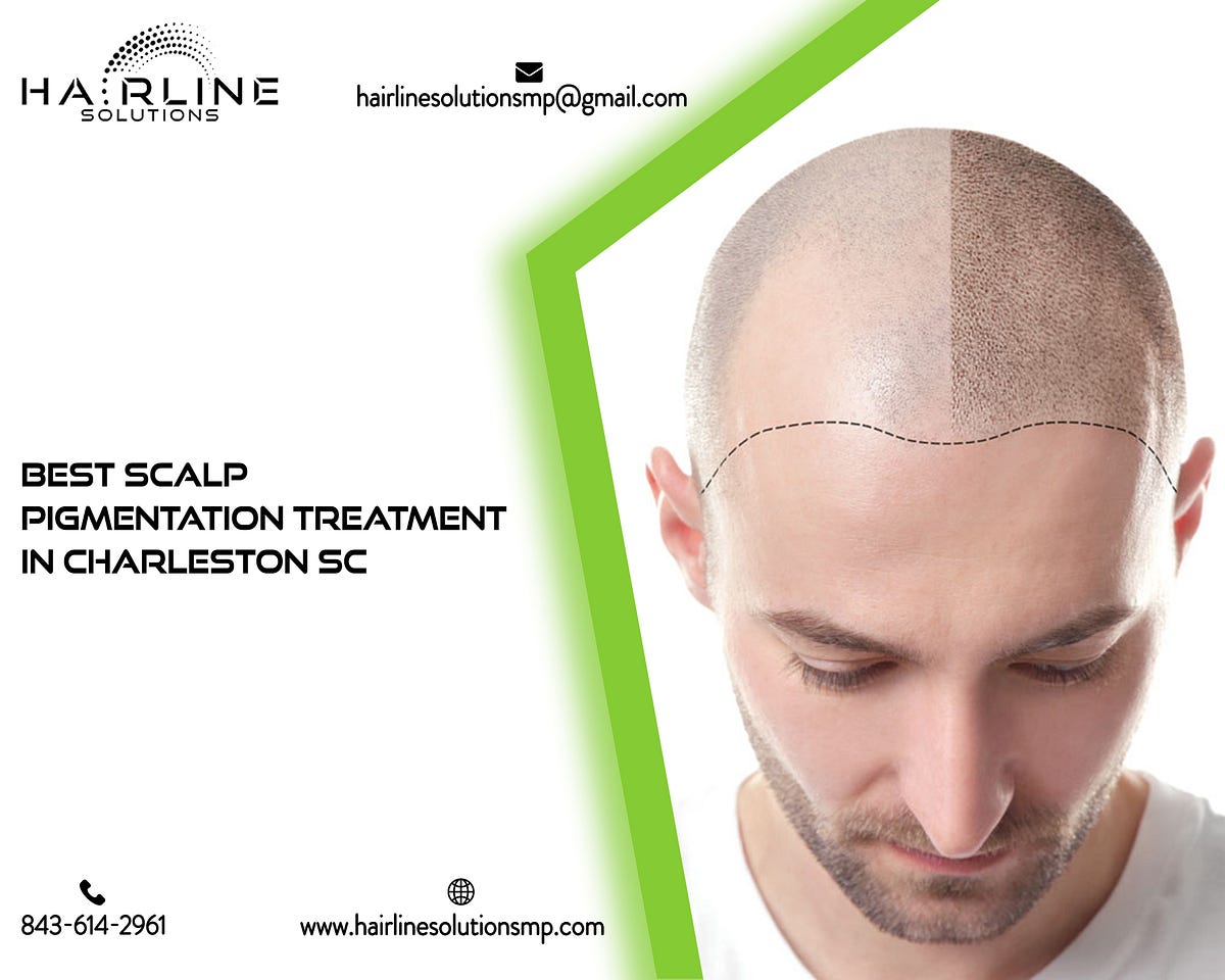 Best Scalp Pigmentation Treatment in Charleston SC Hairline Solutions