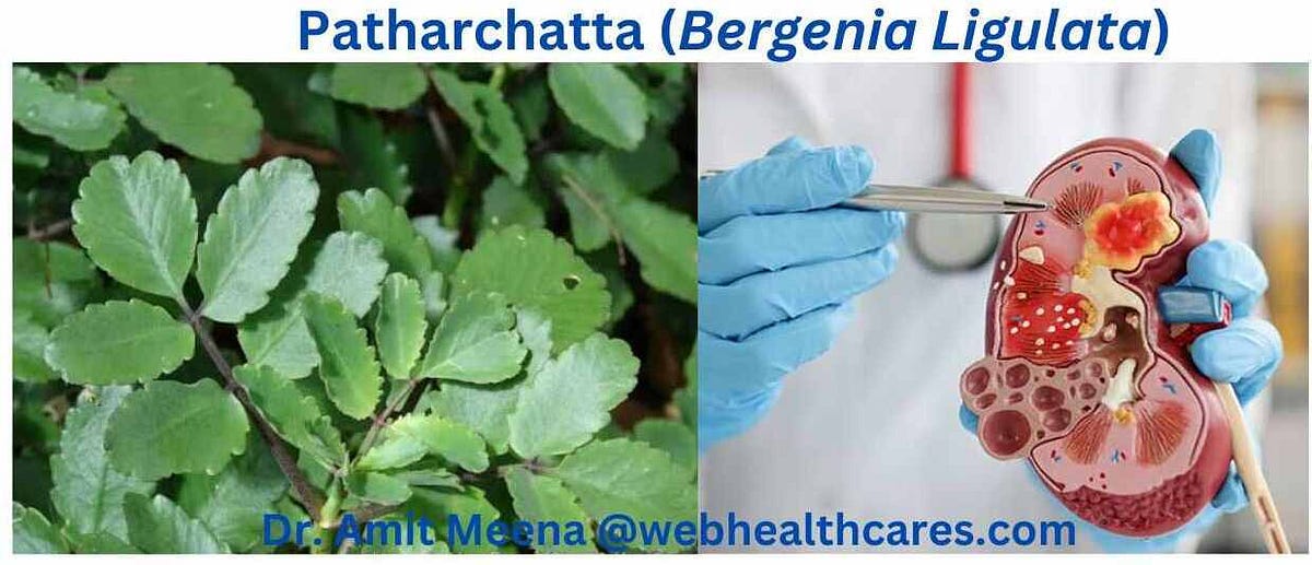 Ayurveda Herbs Help to Dissolve Kidney Stone Dr. Amit Meena Medium