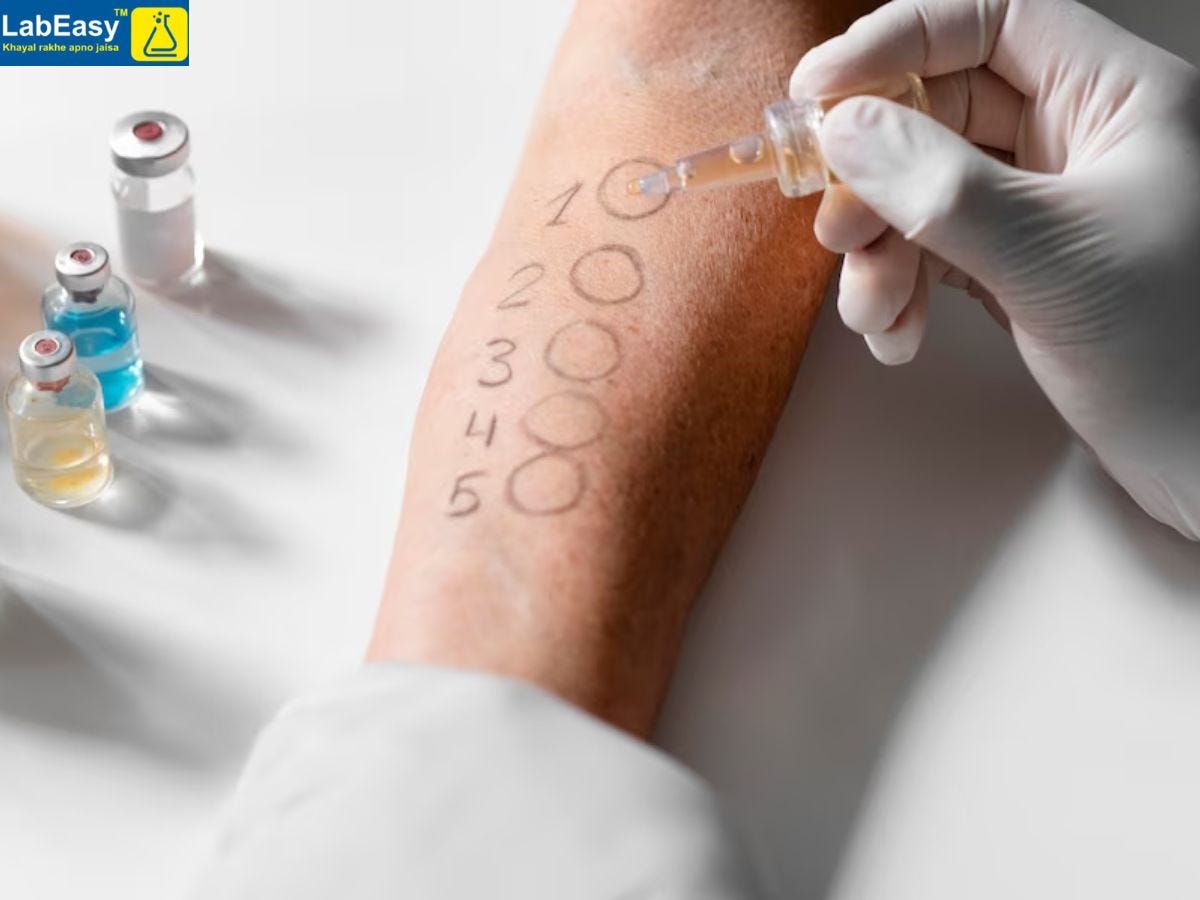 Allergy Test Center In Pune. Introduction In the bustling city of