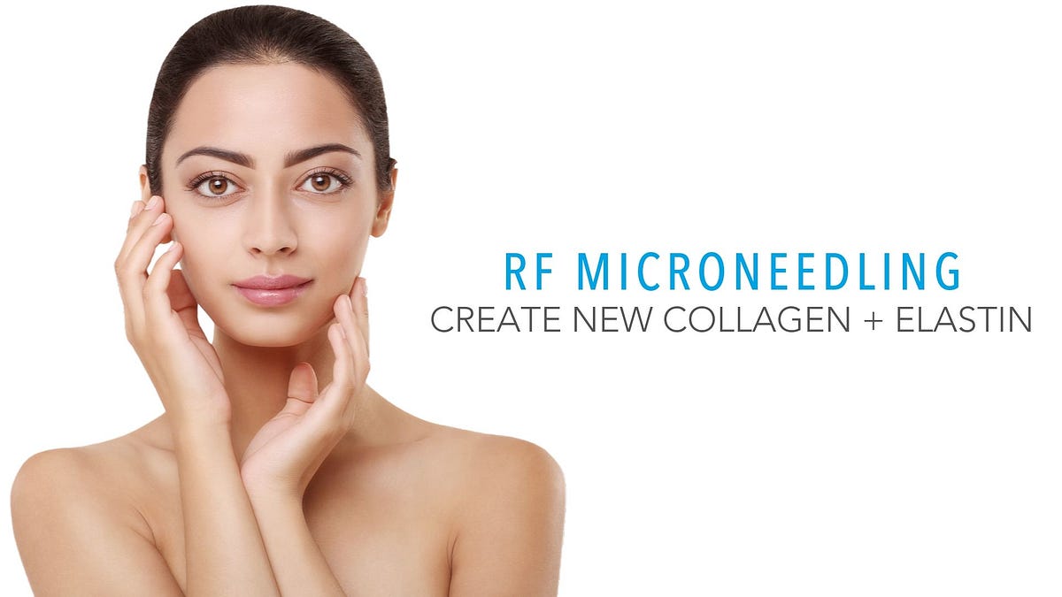 How to prepare skin for RF Microneedling by London Beauty Spot Medium
