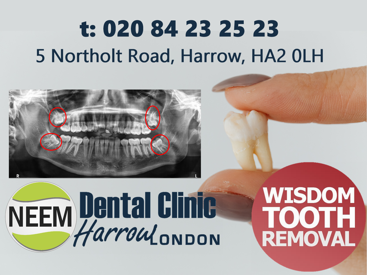 Wisdom Teeth Extraction and Aftercare — Neem Dental Clinic, Harrow by