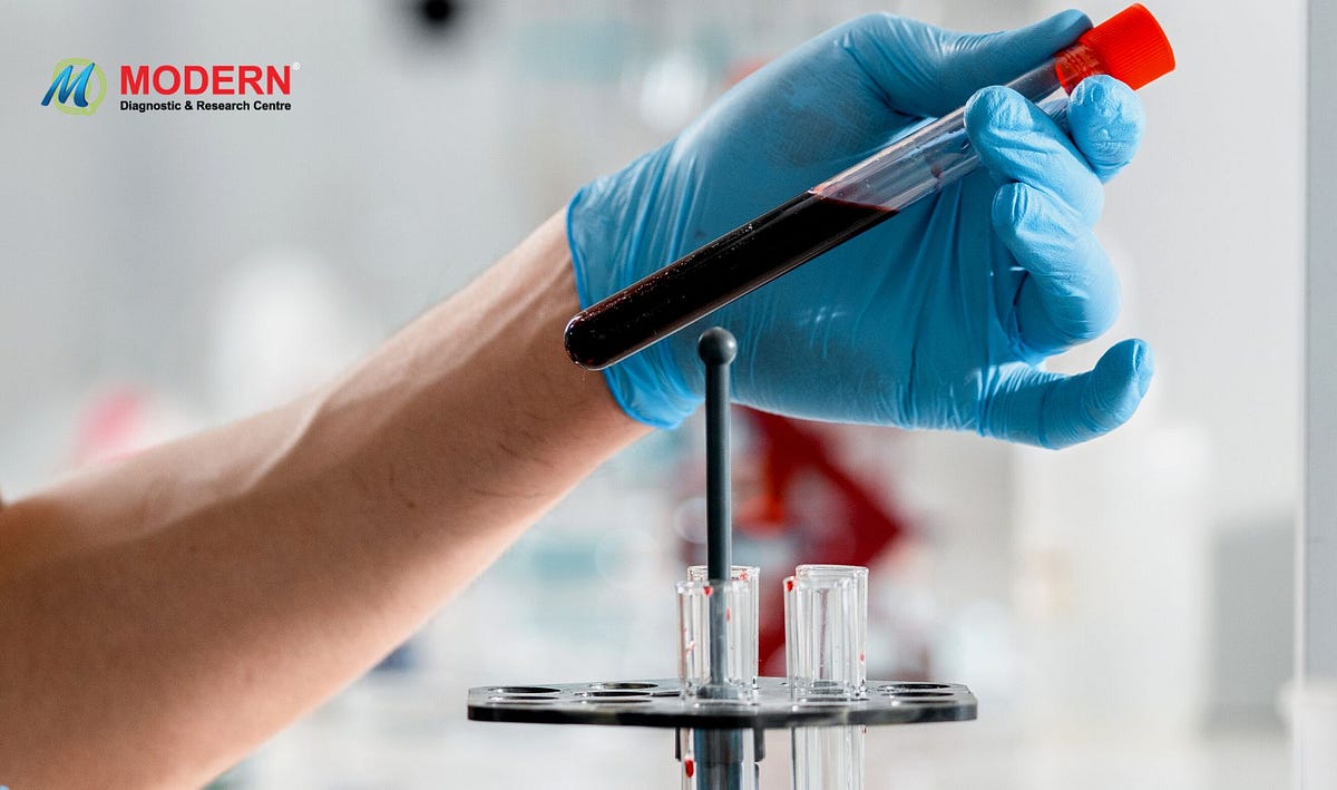 Blood Home Collection For Blood Test in Kolkata MDRC India Medium