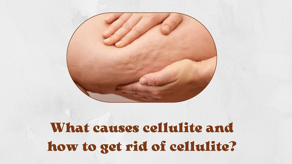 Does Cellulite Go Away When You Lose Weight What causes cellulite and how to get rid of cellulite? - Jamescurley