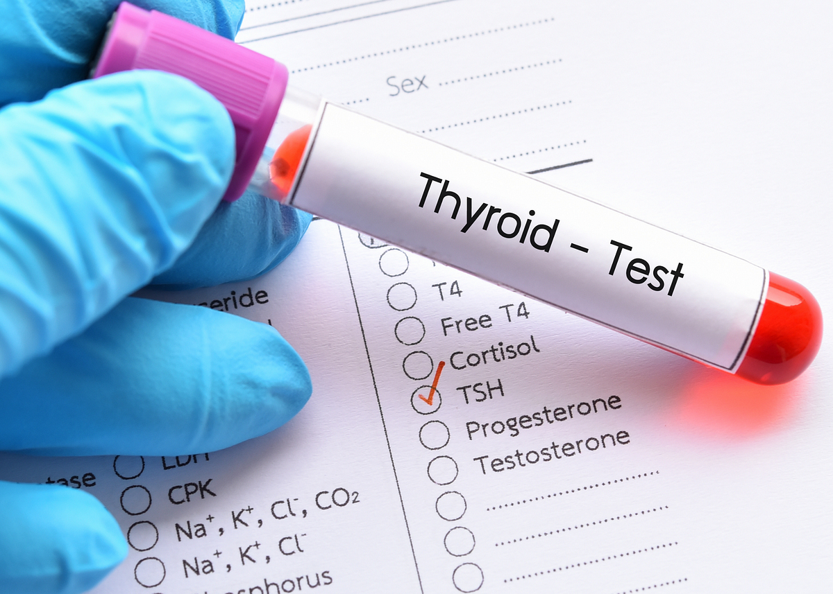 to-tsh-test-or-not-to-tsh-test-it-s-critical-for-anyone-with-thyroid