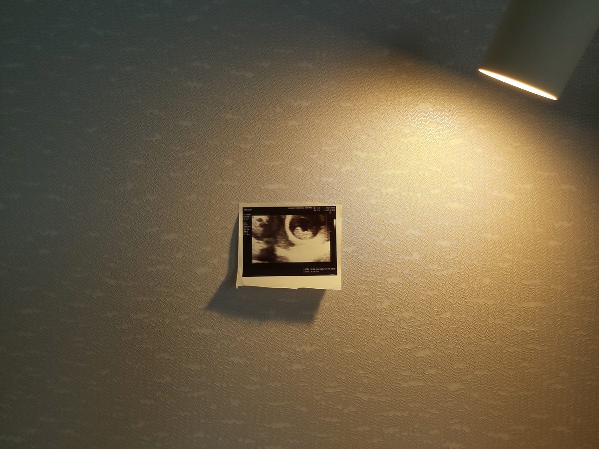 Hi baby, it's you!. Have you ever imagined how it feels to… | by Isabelle  Thye | Be Yourself
