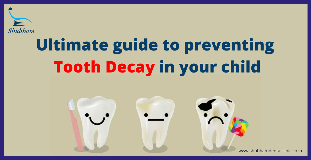 The ultimate guide to preventing tooth decay in your child by Dr