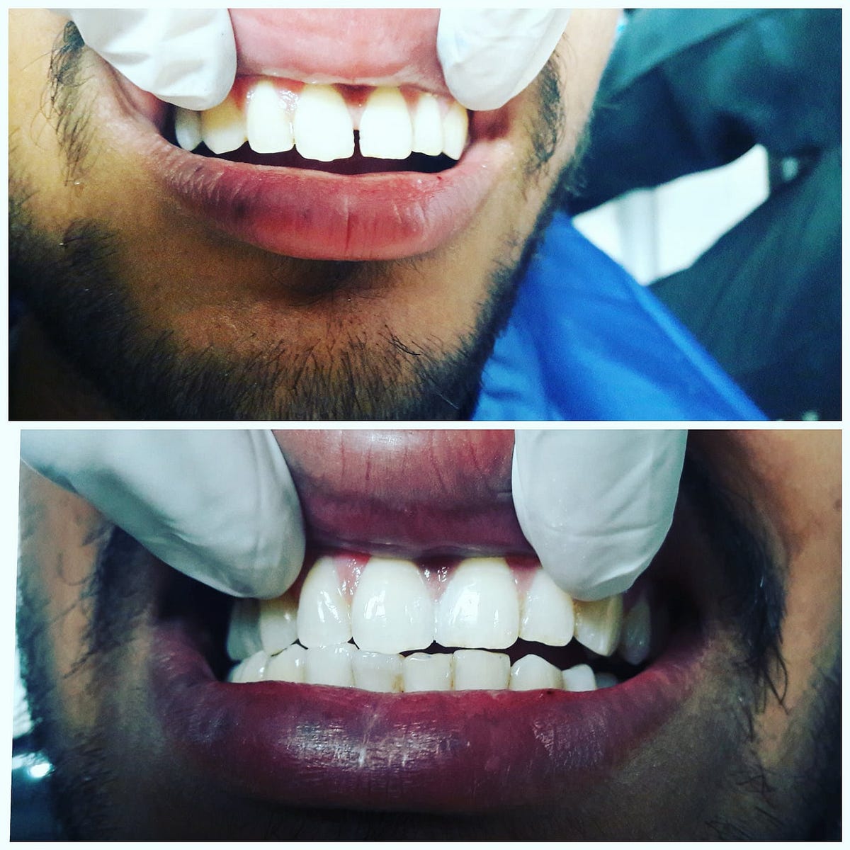 Dental clinic in Patna. We have an expertise in all fields of… by