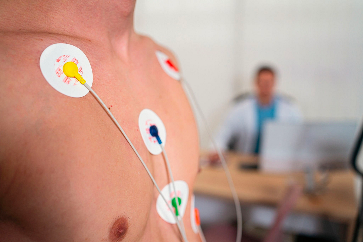 Exploring Electrocardiogram (ECG) The Precision of Electrodes by