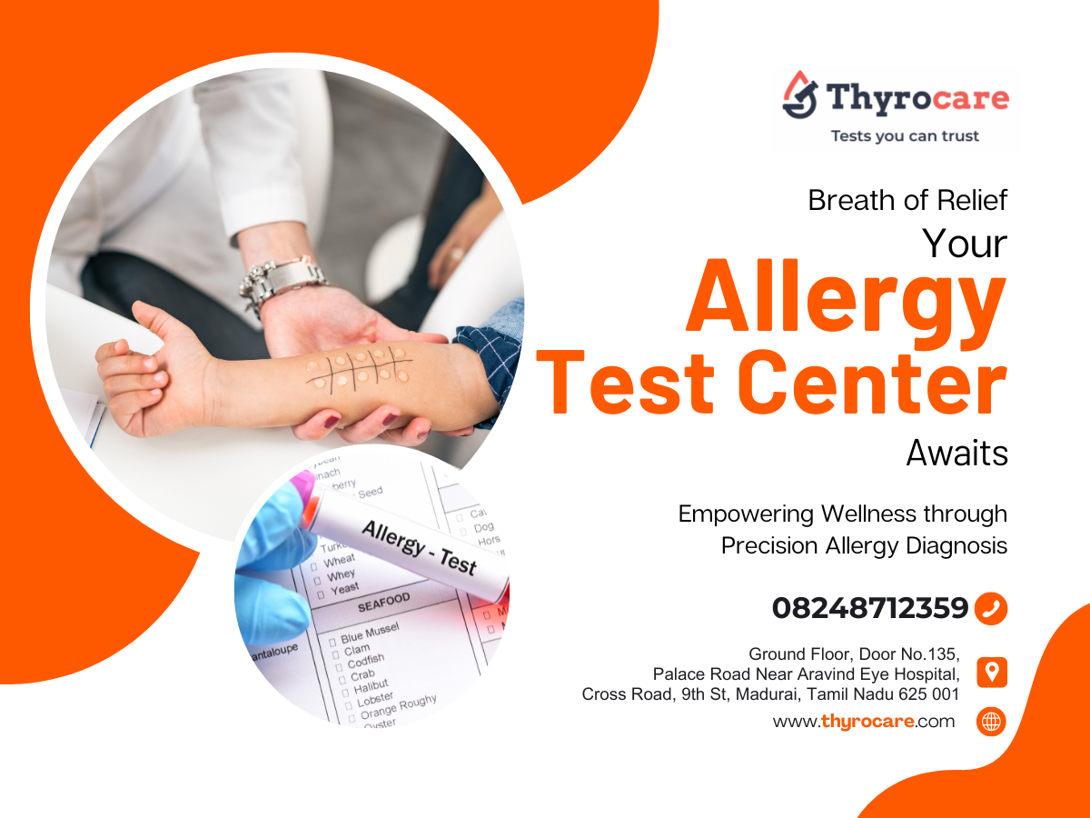 Advanced Allergy Test Center in Madurai by Thyrocare Aarogyam Center