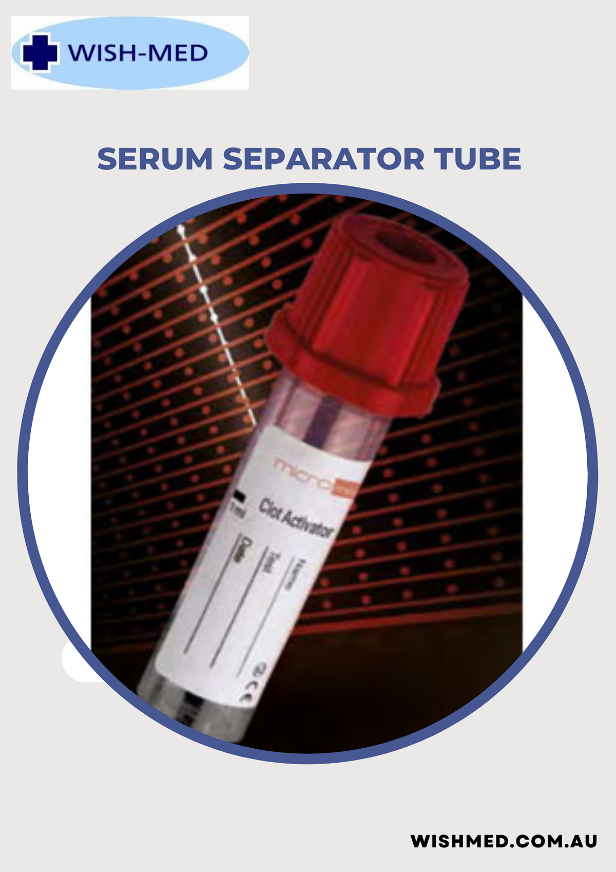 What Are The Major Advantages of Serum Separator Tube? Wishmedwebsite