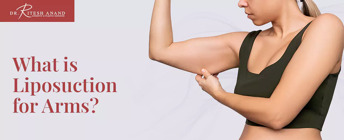 Charlotte Arm Liposuction | Arm Lipo Near Charlotte