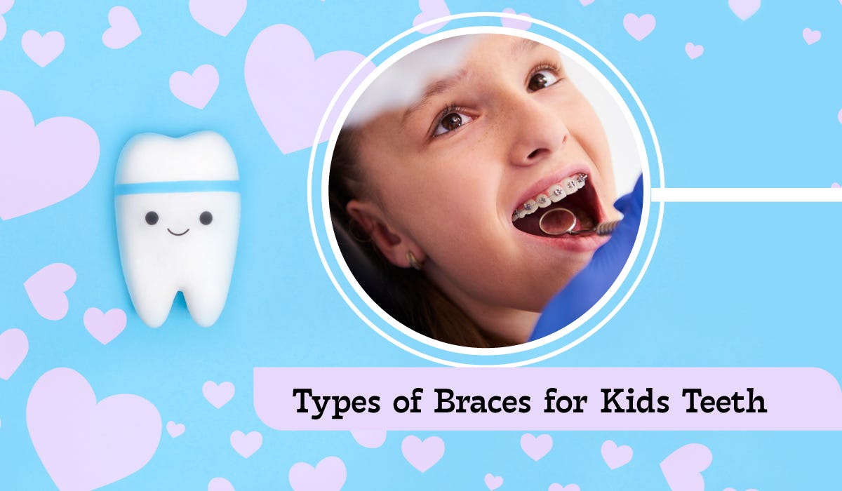 The Different Types of Braces for Kids Teeth by Kidsdentalstudios