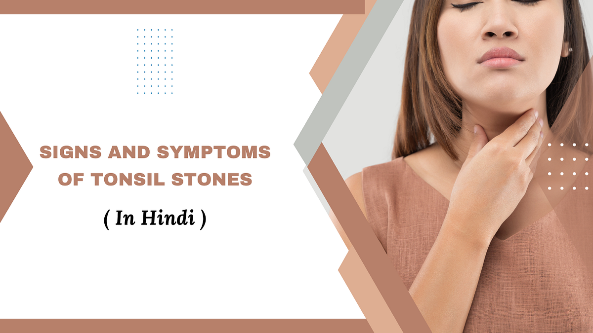 What are the Signs & Symptoms of Tonsil Stones ? (In Hindi ) by