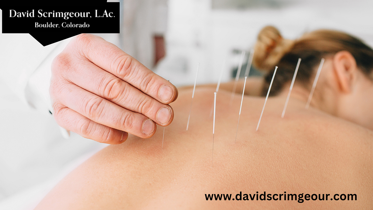 Acupuncture in Boulder Experience Healing with David Scrimgeour
