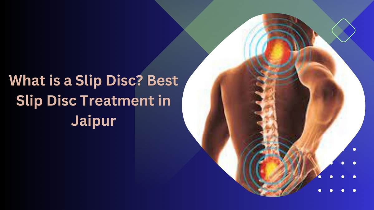 What is a Slip Disc? Best Slip Disc Treatment in Jaipur by