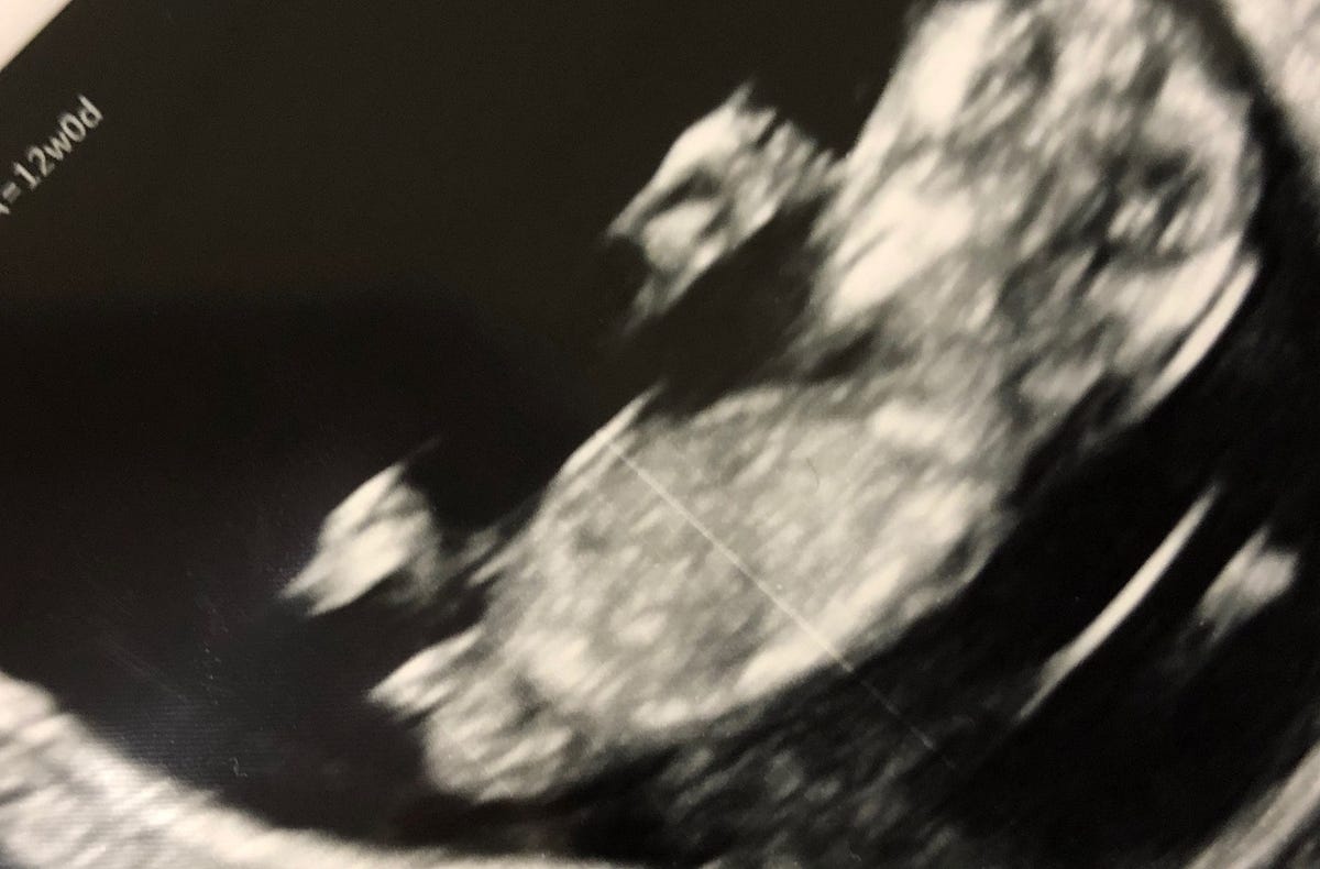 Reflections on a (first) first trimester by Chrissie Dunham Medium